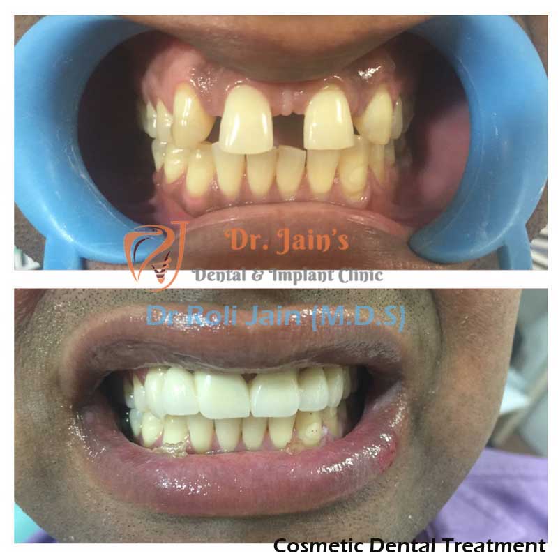 Dr Jain Dental & Implant Clinic