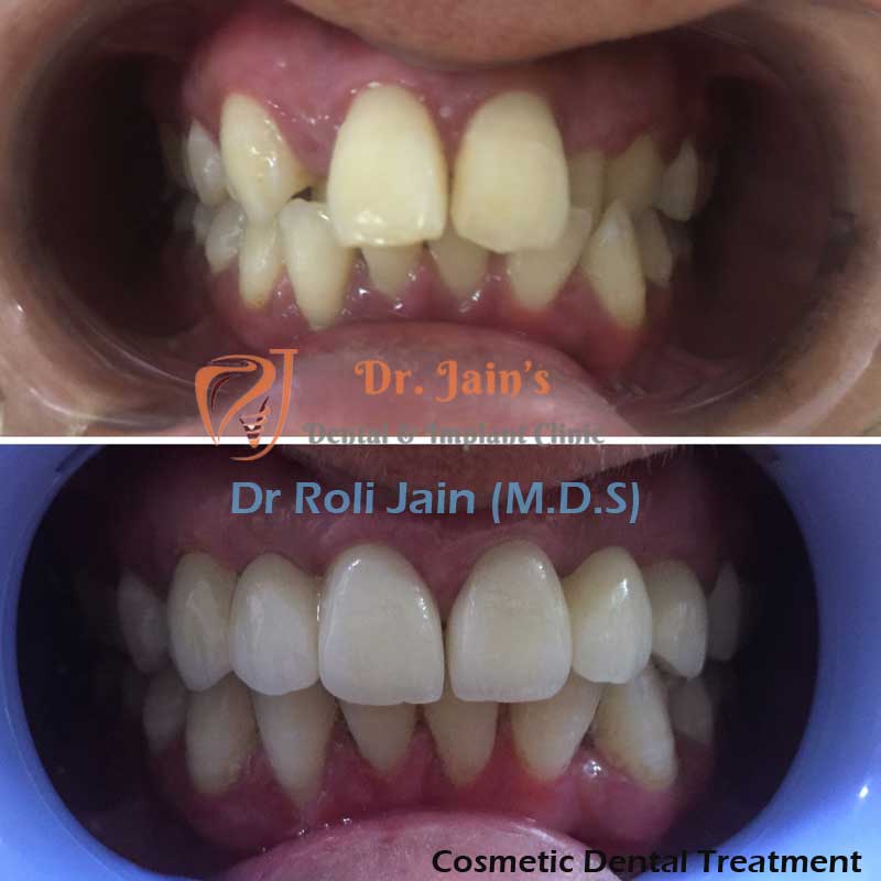 Dr Jain Dental & Implant Clinic