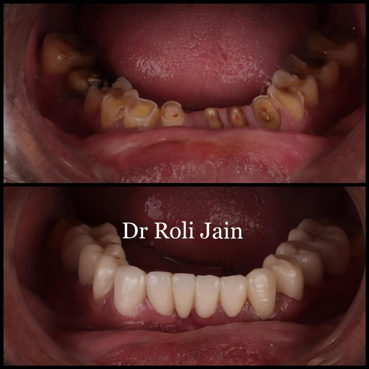 Dr Jain Dental & Implant Clinic