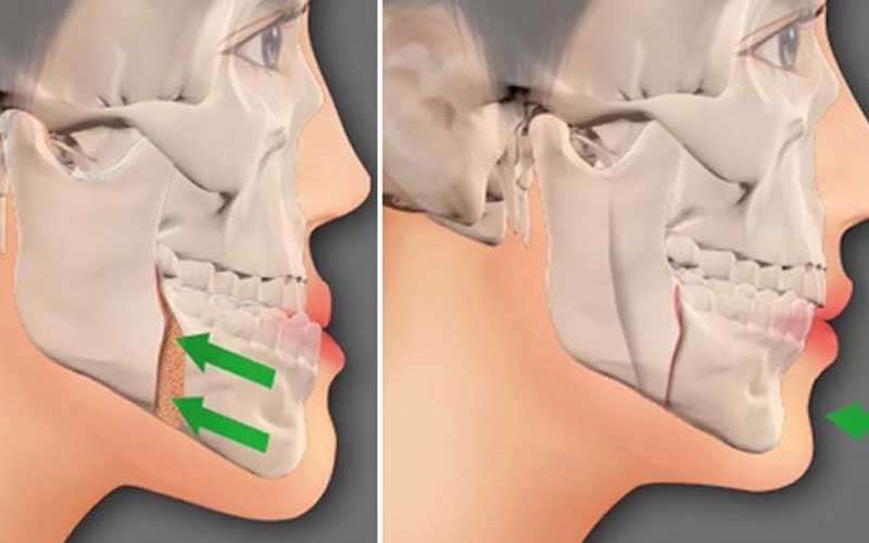 Maxillofacial Surgery