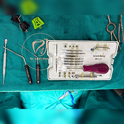 Zygomatic Implants 